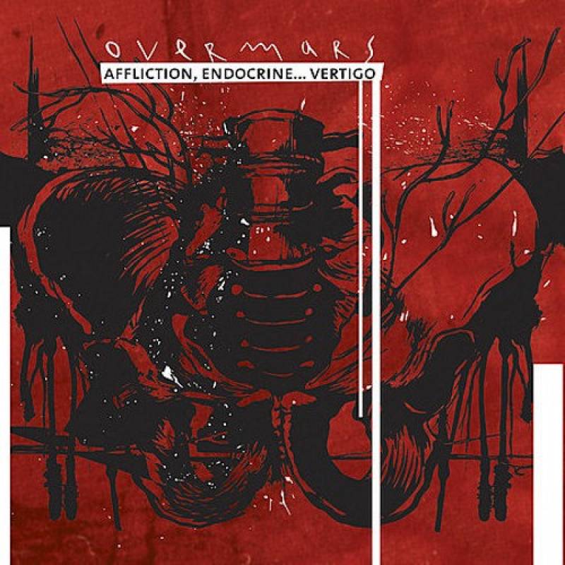 chronique : Overmars - Affliction, Endocrine... Vertigo chronique Overmars - Affliction, Endocrine... Vertigo