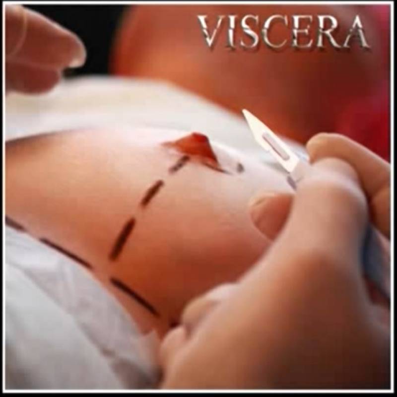 chronique : Viscera - Pathétique chronique Viscera - Pathétique