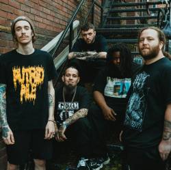 PeelingFlesh