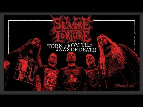 Severe Torture gravement mordu - Torn From the Jaws of Death (actualité) Severe Torture gravement mordu - Torn From the Jaws of Death (actualité)