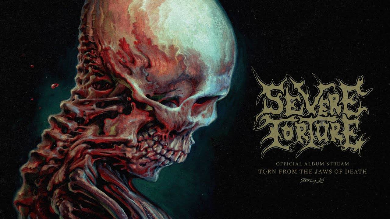 Severe Torture se fait mordre au mollet - Torn From the Jaws of Death (actualité) Severe Torture se fait mordre au mollet - Torn From the Jaws of Death (actualité)